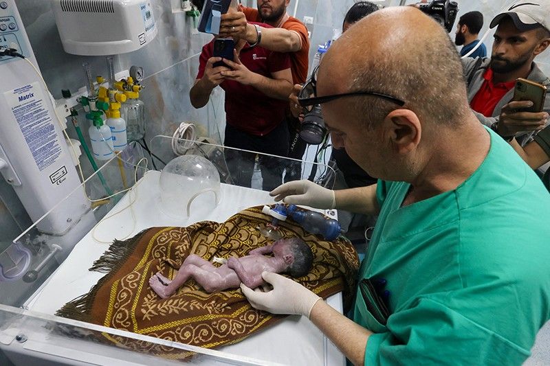 Baby delivered from dying mother's womb in Gaza 'miracle'