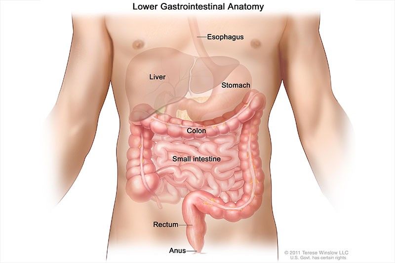 Colorectal cancer now Philippines' number 1 cancer