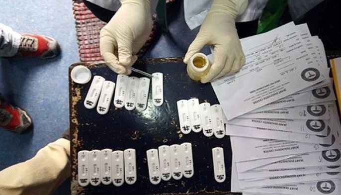 8 city workers test positive of drug use