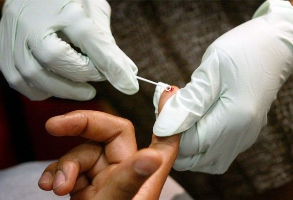 HIV cases rise due to paid sex