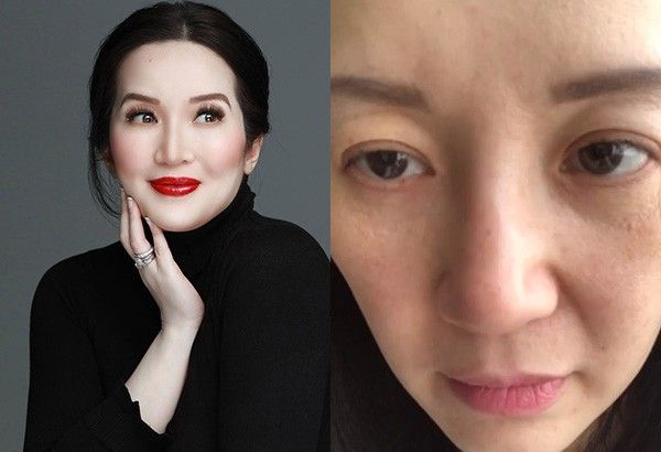 Kris whats aquino on latest Kris Aquino