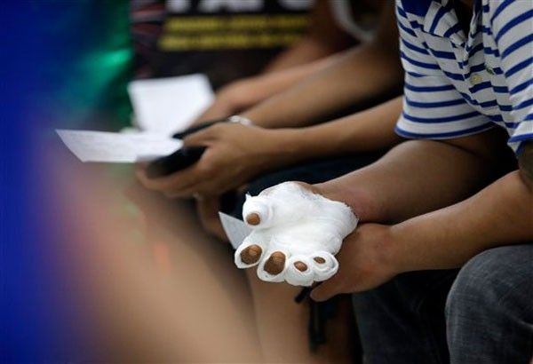 DOH: Firecracker injuries down by 34% from last year