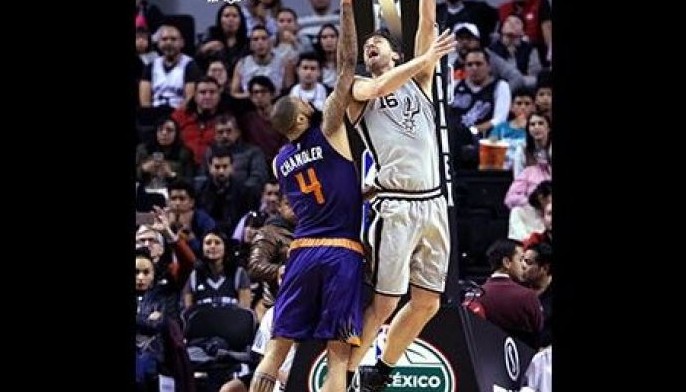 Gasol out indefinitely after hand surgery