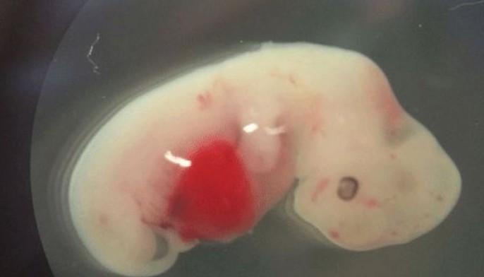 Scientists take first steps to growing human organs in pigs
