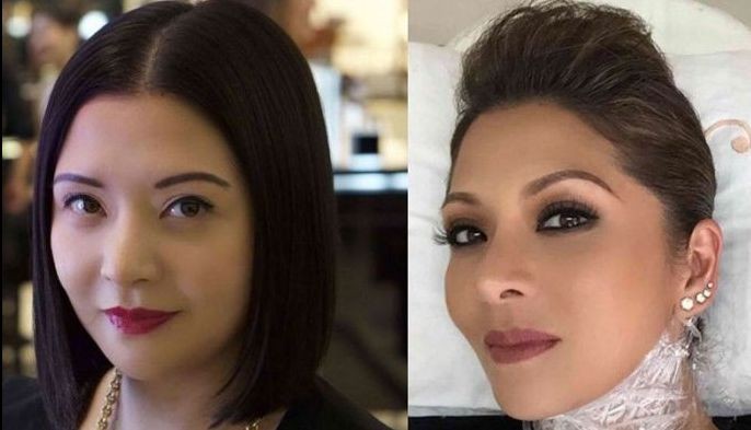 Ultherapy: Cutting-edge without going under the knife