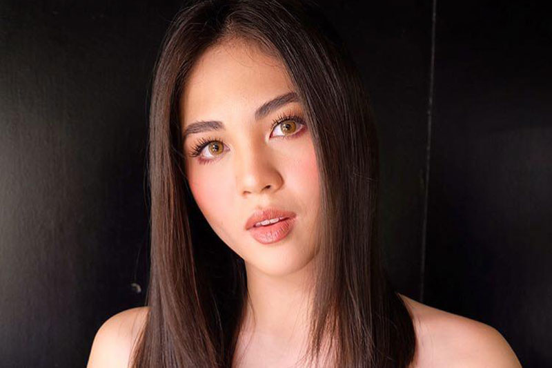 Janella nasunog ang mukha