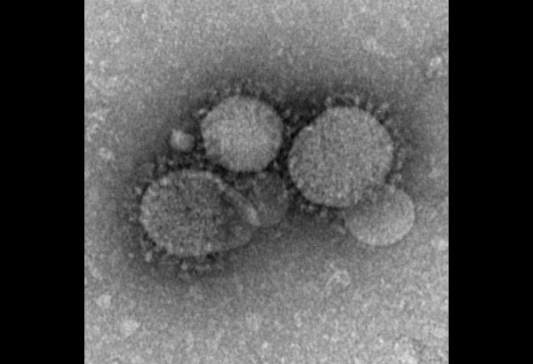 OFW with MERS arrives in Manila