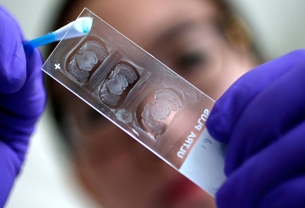 OFW from UAE tests negative for MERS virus