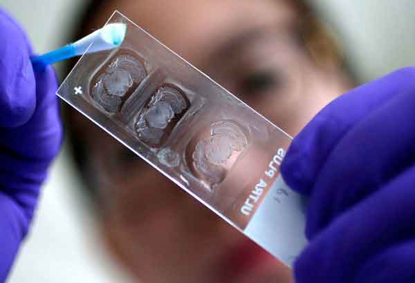 DOH: Strict MERS-CoV screening in place for hajj pilgrims