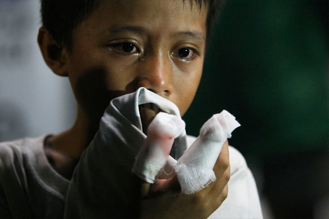 Firecracker-related injuries rise to 839
