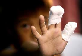10 kids hurt in CDO due to 'piccolo'