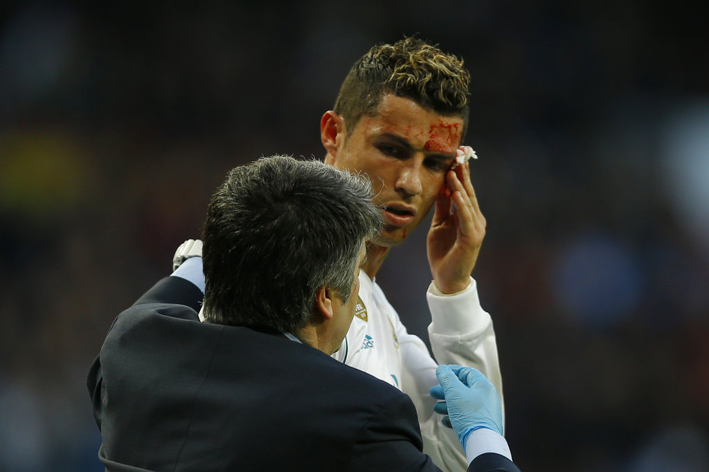 Real Madrid: Ronaldo face cut could have been worse