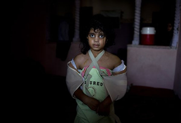 Gaza's wounded: Living reminder of ravages of war
