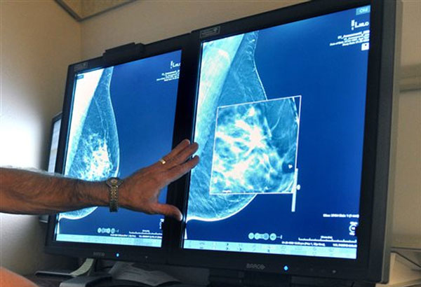 Earliest breast cancer risky for some women, study suggests