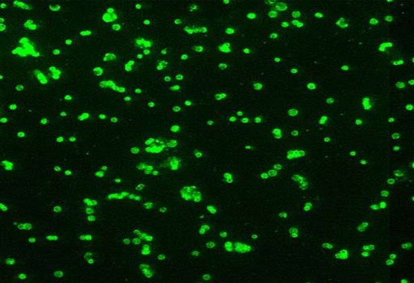 Human cases of 'rabbit fever' have jumped up this year