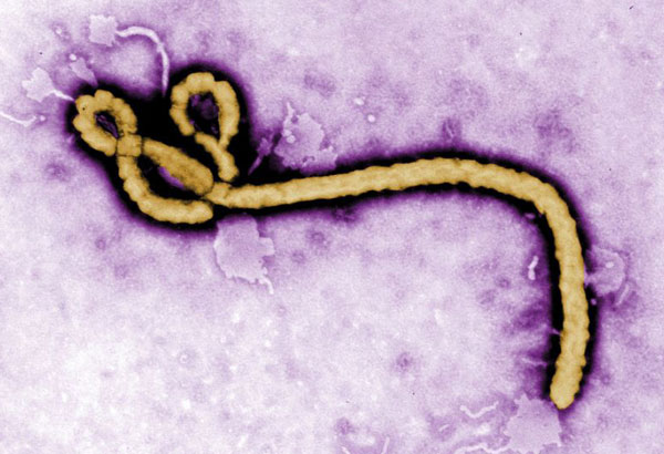 Congo announces 9 suspected Ebola cases, including 3 deaths