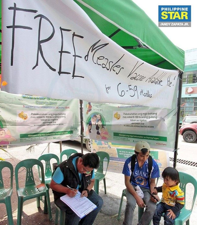 Support anti-measles campaign, LGU execs told