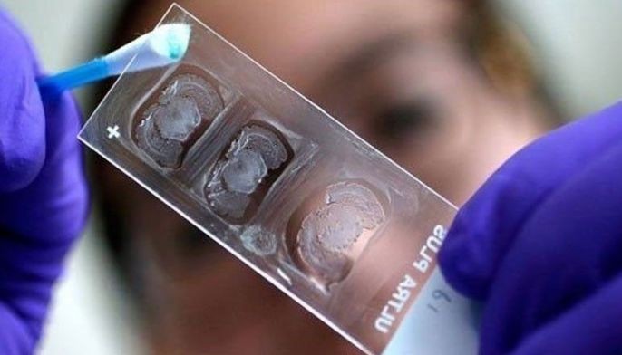 11 governmentt workers test positive of illegal drugs