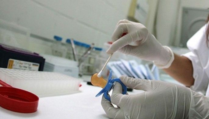 DNA test sa suspek isasama sa booking procedure ng PNP