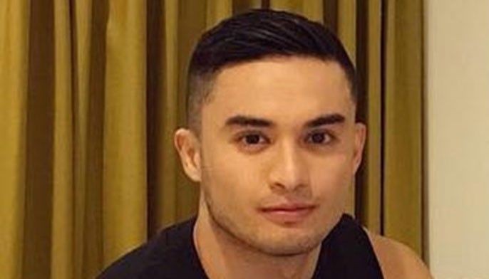 Prince magpapaayos uli ng ilong