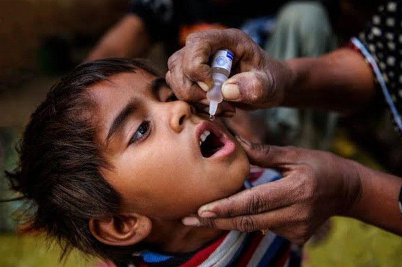 Polio Reemerges In Philippines 19 Years After It Was Eradicated Philstar Com