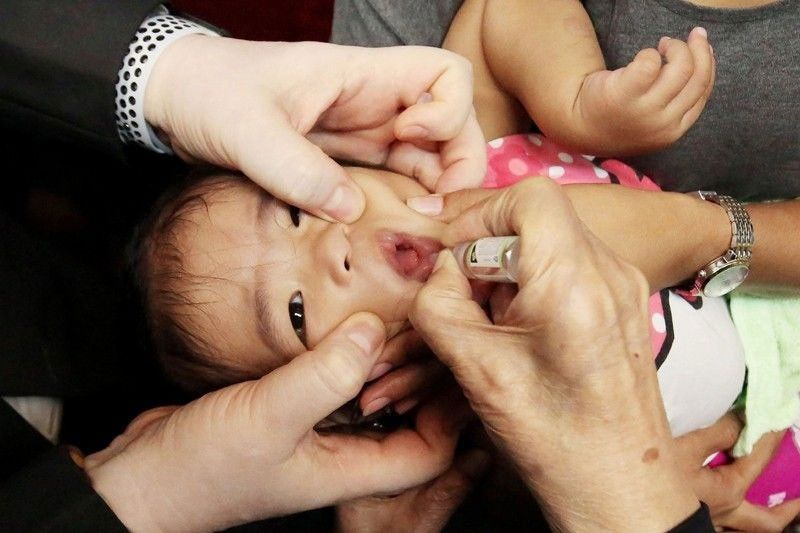 Polio outbreak gideklarar sa DOH tibuok nasud