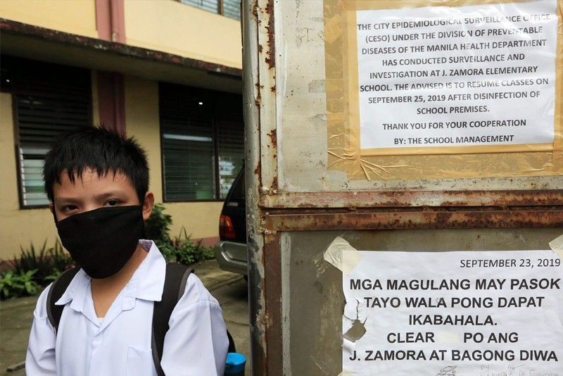 DOH: Manila student died of diphtheria