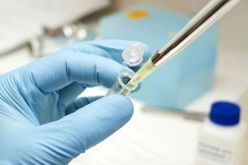 Philippines now capable of testing samples for novel coronavirus â�� DOH