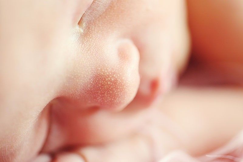 Rubbing vaginal fluid on C-section babies boosts development â study
