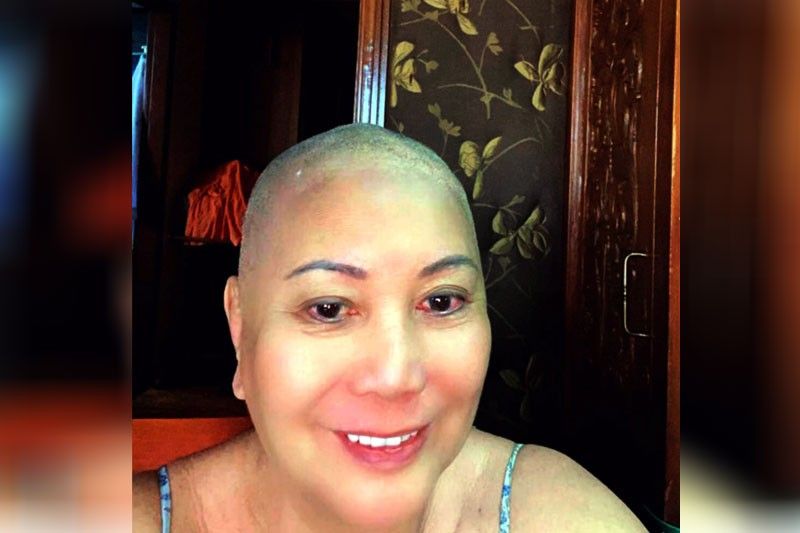 Tetta Agustin-Baverey: bold & bald & beautiful badge of courage