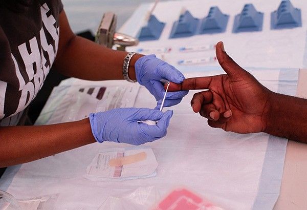 COVID-19 lockdowns could spark rise in HIV infections, experts warn