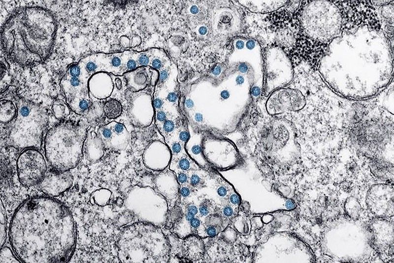 WHO: Coronavirus may never go away