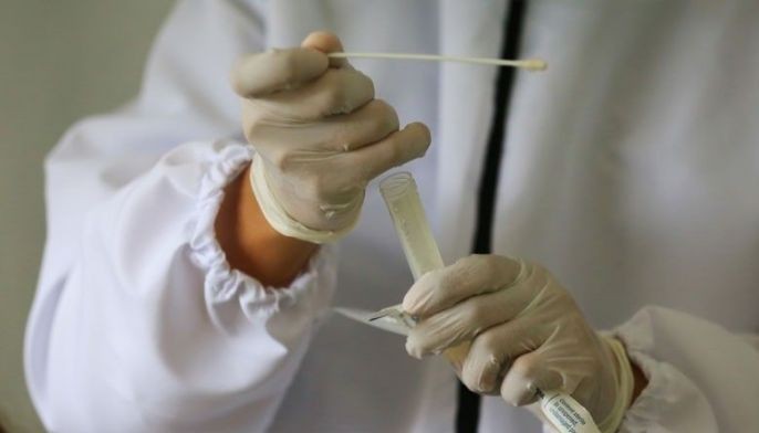 160 PSG positive for COVID-19