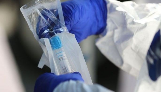 DOH: Test kits sufficient