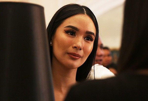 Heart Evangelista opens up about having Burning Tongue Syndrome