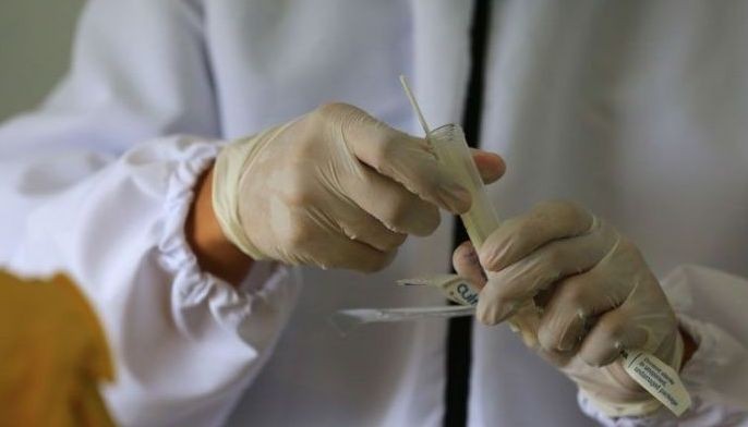 14 labs still to submit results &ndash; DOH
