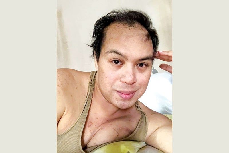 Comedian na si Joey Paras nanghihingi ng tulong, pang-angioplasty!