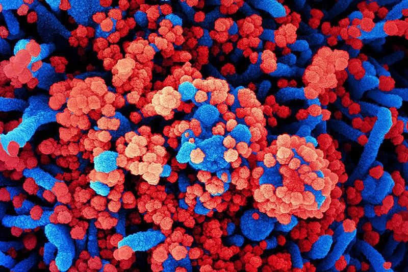 Asymptomatic coronavirus carriers have high viral loads: study