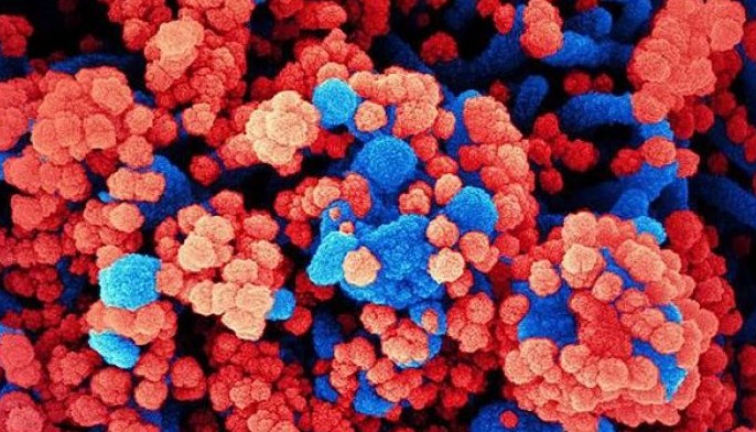 Asymptomatic coronavirus carriers have high viral loads: study