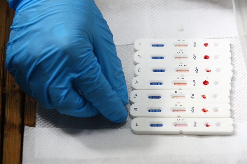 DOH: Rapid antibody tests not for screening COVID-19 cases but still useful