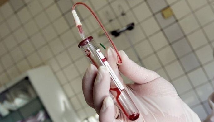 HIV cases, after lull in testing, are now back to pre-pandemic level