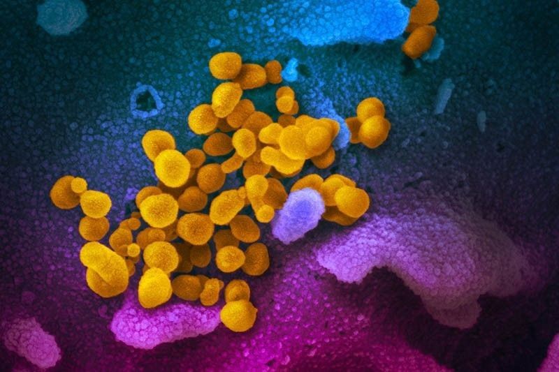 Filipino with new variant now negative for COVID-19; monitoring to continue