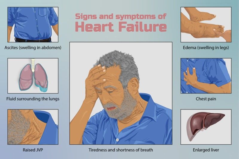 How we can succeed in war vs heart failure