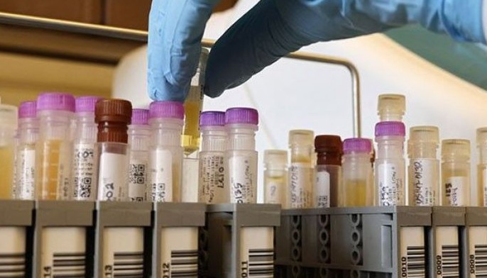 Novavax: COVID-19 vaccine more than 90% effective