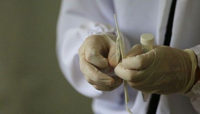 RITM probes Subic Red Cross&rsquo; false positive RT-PCR tests