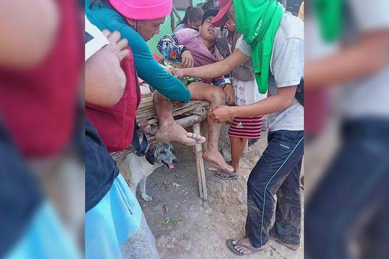 3 residente iniulat na nabaril ng PNP, private guards sa Cavite demolition