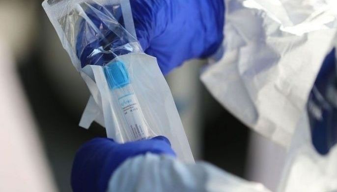MMDA gets donation of P50 million cash, test kits