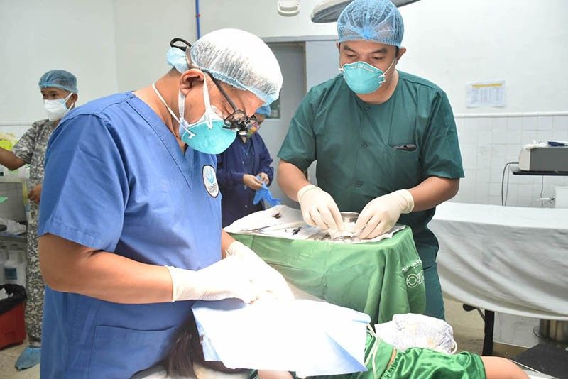 35 children get free cleft-lip, palate surgeries in Zambo