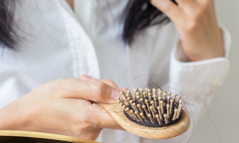 5 ways to prevent excessive hair fall 