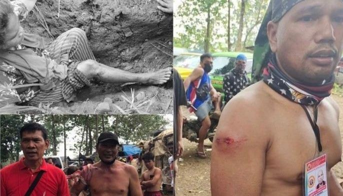 Hearings at House, Senate sought into shooting incident in Bukidnon